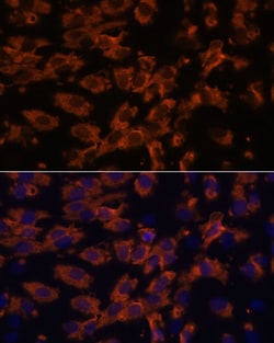 Invitrogen PRX Polyclonal Antibody 100 μL; Unconjugated:Antibodies,
