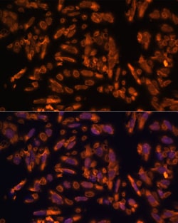 Invitrogen PRX Polyclonal Antibody 100 μL; Unconjugated:Antibodies,