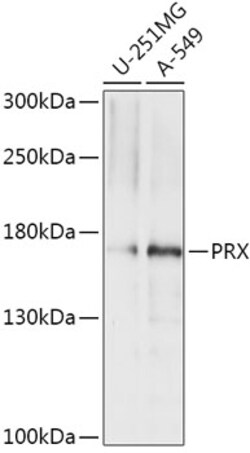 Invitrogen PRX Polyclonal Antibody 100 μL; Unconjugated:Antibodies,