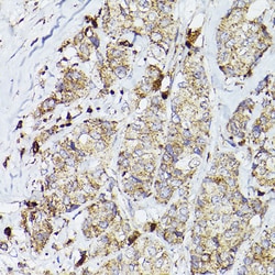 Invitrogen PSAP Polyclonal Antibody 100 &mu;L; Unconjugated:Antibodies,