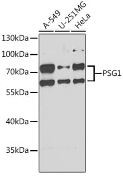 Invitrogen PSG1 Polyclonal Antibody 100 &mu;L | Buy Online | Invitrogen&trade; | Fisher Scientific