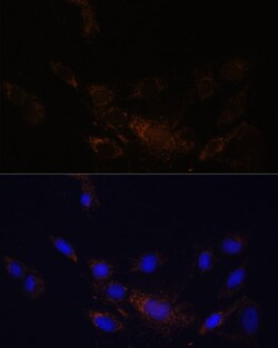 Invitrogen PSMB7 Polyclonal Antibody 100 μL; Unconjugated:Antibodies,