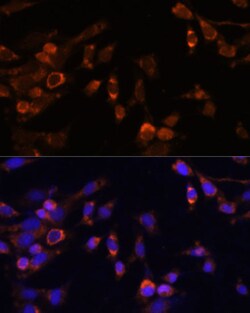 Invitrogen PSMB7 Polyclonal Antibody 100 μL; Unconjugated:Antibodies,