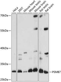 Invitrogen PSMB7 Polyclonal Antibody 100 μL; Unconjugated:Antibodies,
