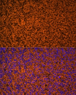 PTCH Polyclonal Antibody:Antibodies, Polyclonal