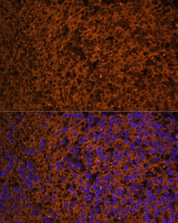 PTCH Polyclonal Antibody:Antibodies, Polyclonal