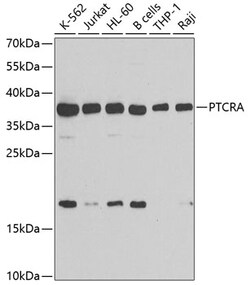 Invitrogen PTCRA Polyclonal Antibody 100 &mu;L; Unconjugated:Antibodies,