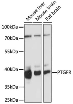 Invitrogen PTGFR Polyclonal Antibody 100 &mu;L; Unconjugated:Antibodies,