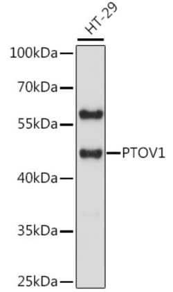 PTOV1 Polyclonal Antibody 100 &mu;L | Buy Online | Invitrogen | Fisher Scientific