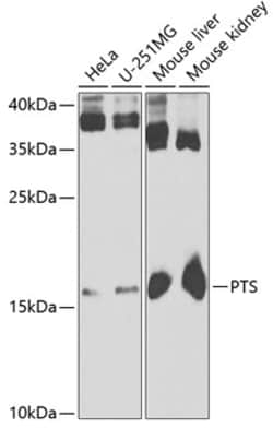 Invitrogen PTS Polyclonal Antibody 100 μL; Unconjugated:Antibodies,