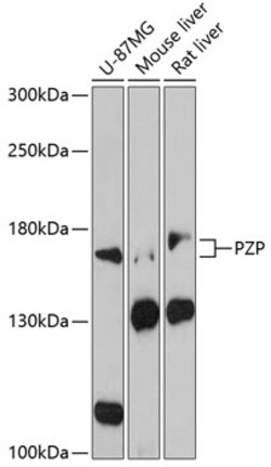 Invitrogen PZP Polyclonal Antibody 100 &mu;L; Unconjugated:Antibodies,