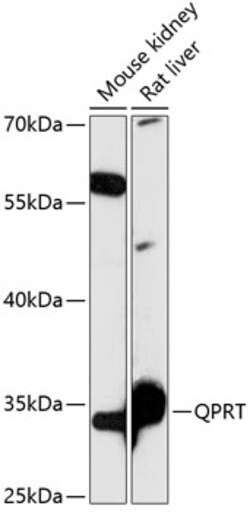 Invitrogen QPRT Polyclonal Antibody 100 &mu;L; Unconjugated:Antibodies,