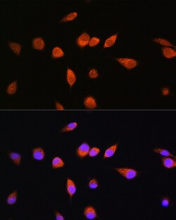 Invitrogen RAB20 Polyclonal Antibody 100 μL; Unconjugated:Antibodies,