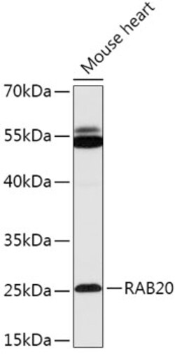 Invitrogen RAB20 Polyclonal Antibody 100 μL; Unconjugated:Antibodies,