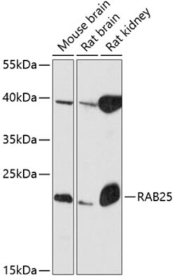 Invitrogen RAB25 Polyclonal Antibody 100 &mu;L; Unconjugated:Antibodies,