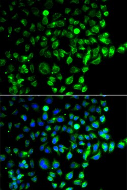 Invitrogen RAB31 Polyclonal Antibody 100 μL; Unconjugated:Antibodies,