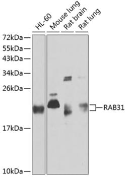 Invitrogen RAB31 Polyclonal Antibody 100 μL; Unconjugated:Antibodies,