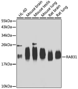 Invitrogen RAB31 Polyclonal Antibody 100 &mu;L; Unconjugated:Antibodies,