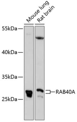 Invitrogen RAB40A Polyclonal Antibody 100 &mu;L; Unconjugated:Antibodies,