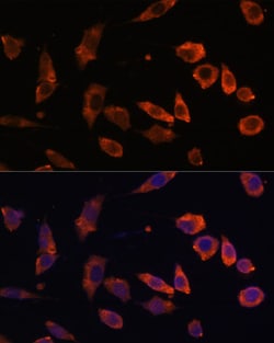 Invitrogen RAB5B Polyclonal Antibody 100 μL; Unconjugated:Antibodies,
