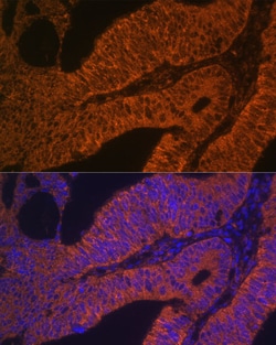 Invitrogen RAB5B Polyclonal Antibody 100 μL; Unconjugated:Antibodies,