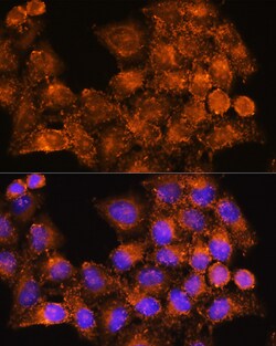 Invitrogen RAB7B Polyclonal Antibody 100 &mu;L; Unconjugated:Antibodies,
