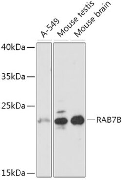 Invitrogen RAB7B Polyclonal Antibody 100 &mu;L; Unconjugated:Antibodies,