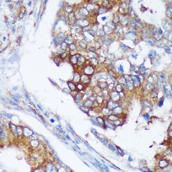 Invitrogen RABGAP1 Polyclonal Antibody 100 μL; Unconjugated:Antibodies,
