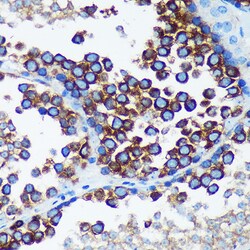 Invitrogen RABGAP1 Polyclonal Antibody 100 μL; Unconjugated:Antibodies,