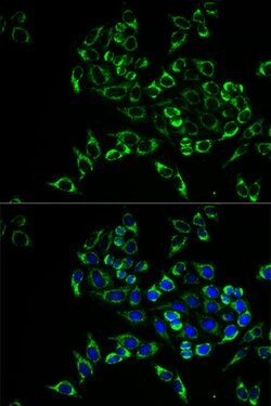 RANKL Polyclonal Antibody, Invitrogen 100 &mu;L; Unconjugated:Antibodies,