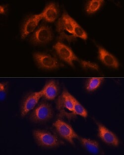 Invitrogen RAPH1 Polyclonal Antibody 100 &mu;L; Unconjugated:Antibodies,