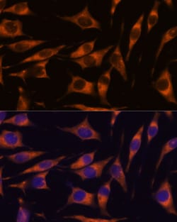 Invitrogen RAPH1 Polyclonal Antibody 100 &mu;L; Unconjugated:Antibodies,
