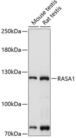 RASA1 Polyclonal Antibody 100 &mu;L | Buy Online | Invitrogen | Fisher Scientific