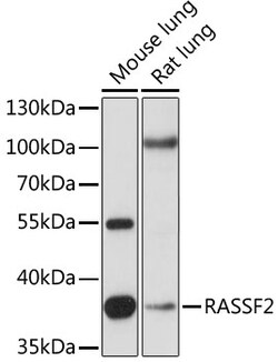 RASSF2 Polyclonal Antibody 100 &mu;L | Buy Online | Invitrogen | Fisher Scientific