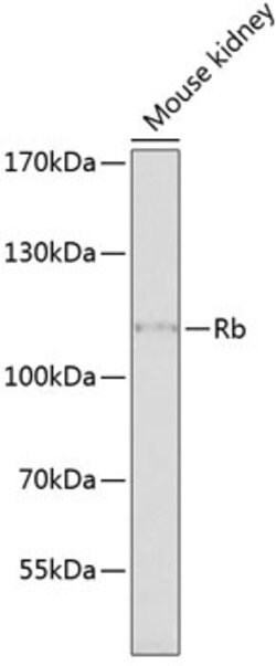 Rb Polyclonal Antibody, Invitrogen 100 &mu;L; Unconjugated:Antibodies,