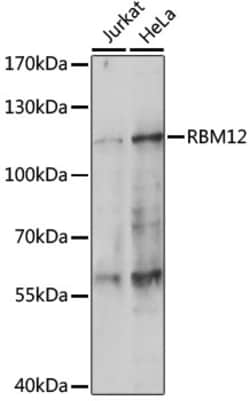 Invitrogen RBM12 Polyclonal Antibody 100 μL; Unconjugated:Antibodies,