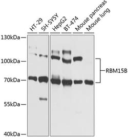 Invitrogen RBM15B Polyclonal Antibody 100 &mu;L; Unconjugated:Antibodies,