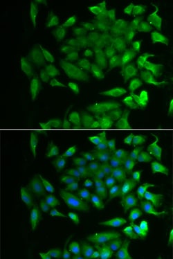 Invitrogen RBP2 Polyclonal Antibody 100 μL; Unconjugated:Antibodies,