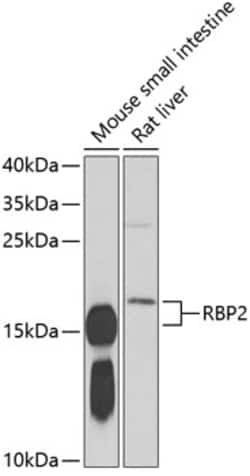 Invitrogen RBP2 Polyclonal Antibody 100 μL; Unconjugated:Antibodies,
