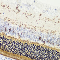Invitrogen Recoverin Polyclonal Antibody 100 &mu;L; Unconjugated:Antibodies,