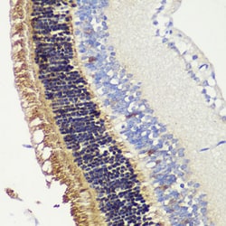 Invitrogen Recoverin Polyclonal Antibody 100 &mu;L; Unconjugated:Antibodies,