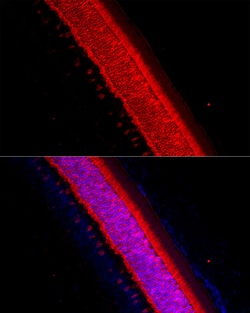 Invitrogen Recoverin Polyclonal Antibody 100 &mu;L; Unconjugated:Antibodies,