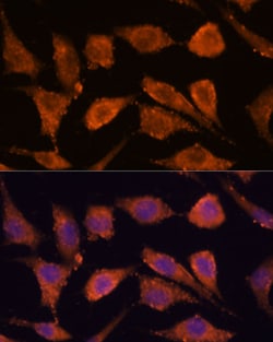 Invitrogen RHBDF1 Polyclonal Antibody 100 &mu;L; Unconjugated:Antibodies,