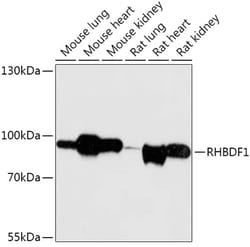 Invitrogen RHBDF1 Polyclonal Antibody 100 &mu;L; Unconjugated:Antibodies,