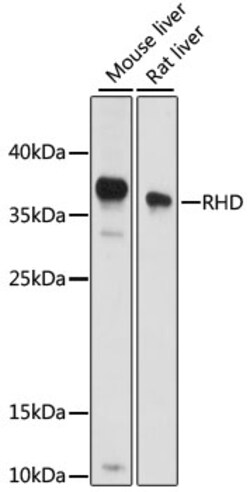 Invitrogen RHD Polyclonal Antibody 100 &mu;L; Unconjugated:Antibodies,