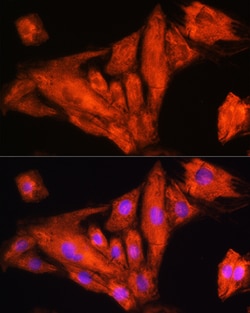 Invitrogen RIG-I Polyclonal Antibody 100 &mu;L; Unconjugated:Antibodies,