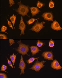 Invitrogen RIG-I Polyclonal Antibody 100 &mu;L; Unconjugated:Antibodies,