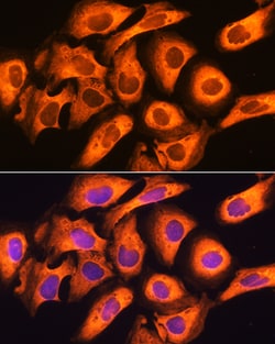 Invitrogen RIG-I Polyclonal Antibody 100 &mu;L; Unconjugated:Antibodies,