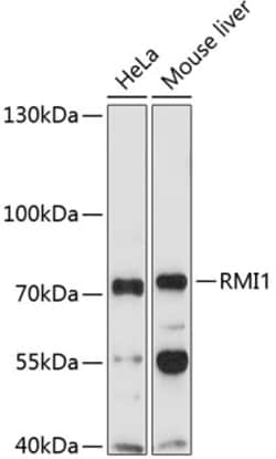 Invitrogen RMI1 Polyclonal Antibody 100 &mu;L | Buy Online | Invitrogen&trade; | Fisher Scientific