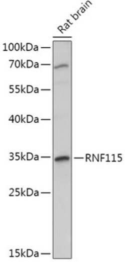 Invitrogen RNF115 Polyclonal Antibody 100 &mu;L; Unconjugated:Antibodies,